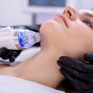 Microneedling for Acne Scars: Before/After Timeline & How Many Sessions You’ll Need