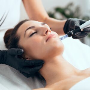 Microneedling 101: Everything You Need to Know About Collagen Induction Therapy