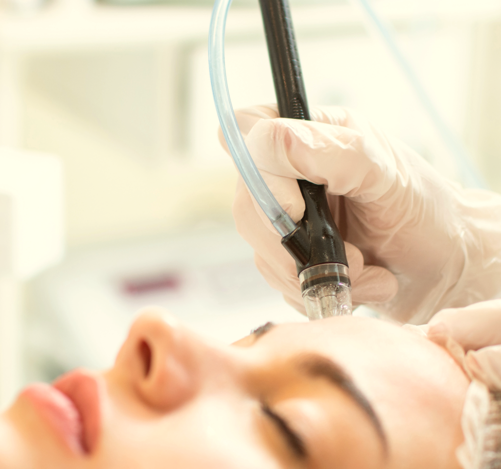 Why Is Hydrafacial the Ultimate Hydrating Facial for Radiant Skin?
