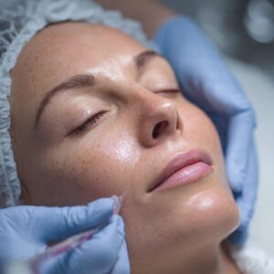 Sculptra vs Filler for Facial Volume Loss