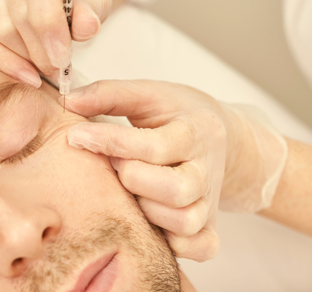 Sculptra vs Traditional Filler: The Collagen-Building Difference