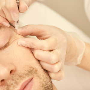 Chemical Peel for Back Acne (Bacne): How It Works, Benefits, and Treatment Options