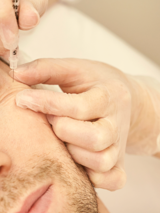 Sculptra vs Traditional Filler: The Collagen-Building Difference