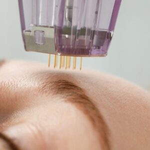Collagen Banking in Your 20s and 30s: The Smartest Investment You’ll Make