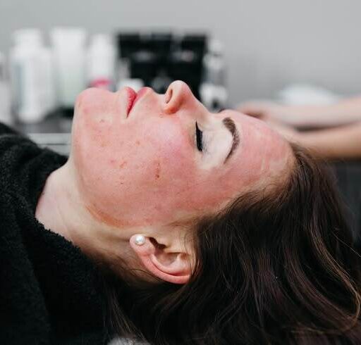 Regenerative Aesthetics in 2026: The Biostimulation Revolution